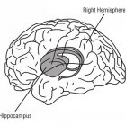 Geheugenchip vervangt de hippocampus