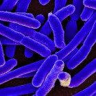 E. coli-experiment Richard Lenski: bewijs voor evolutie?