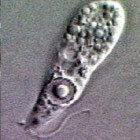 Naegleria fowleri, een gevaarlijke hersenetende amoebe