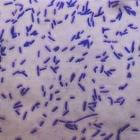 Bacteriën nader bekeken: de Gram-kleuring