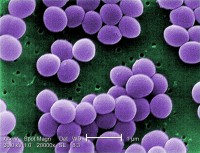 Stafylococcus Aureus (veel voorkomende bacterie van de huid) onder een elektronenmicroscoop  / Bron: CDC/ Matthew J. Arduino, DRPH / Janice Haney Carr, Wikimedia Commons (Publiek domein)