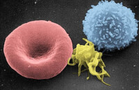 Bloedcellen / Bron: Electron Microscopy Facility (NCI Frederick), Wikimedia Commons (Publiek domein)